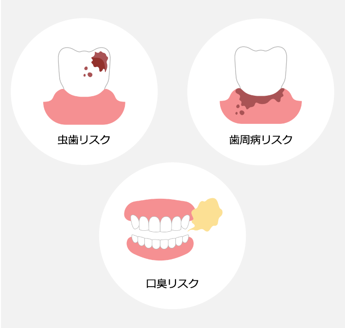 虫歯リスク・歯周病リスク・口臭リスク